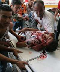 Un palestino herido es atendido en Gaza