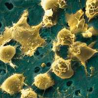 Aspecto de células madre