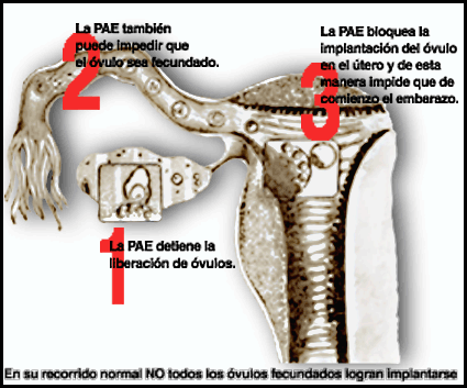 ls-pae
