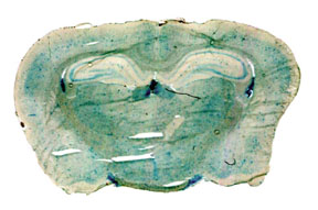 cerebro