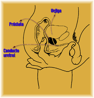 ls-prostata1