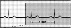 apm-1-1202