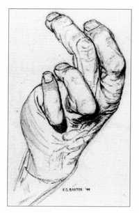 La mano baldada