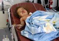 En Bagdad, Zahraa Abdullah, de un año, resultó lesionada por la explosión de un camión bomba. La madre de la pequeña perdió la vida en el atentado