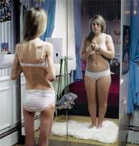 Dudosa percepción. La anorexia, un desequilibrio sicológico