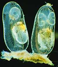 Científicos de la Universidad James Cook y del Instituto de Ciencia Marina, de Australia, afirman que el cambio climático puede estar causando que los peces de arrecife se pierdan y sean incapaces de regresar a las áreas de desove, lo que tendría graves consecuencias para la supervivencia de esos ecosistemas. Arriba, imagen microscópica de huevos de pez antes de ser implantados. La otra gráfica corresponde a una larva con los otolitos visibles entre las dos áreas oscuras