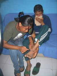 Emeterio Merino Cruz, simpatizante de la Asamblea Popular de los Pueblos de Oaxaca, aún tiene problemas para ver y caminar debido a la golpiza que le dieron policías el 16 de julio de 2007