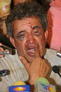 El diputado petista José Manuel Pérez Vega ofreció conferencias de prensas en las que acusó a policías del municipio de Tlacotepec, Puebla, de golpearlo, torturarlo, arrojarlo a un barranco y dispararle. El legislador y dos acompañantes pretendían recabar testimonios sobre presuntos abusos del edil priísta Esteban Gorgonio Merino