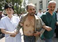 Médicos georgianos atienden en Tbilisi a un hombre que fue liberado por la milicia de Osetia del Sur