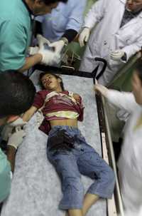 Médicos atienden en el hospital de Beit Lahiya a una niña palestina.
