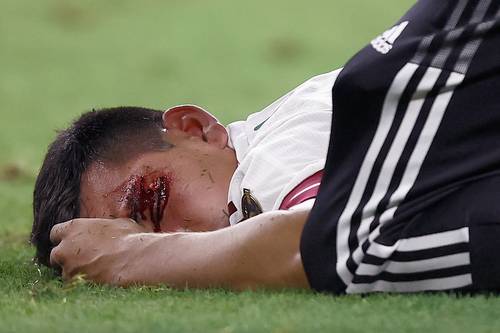 Hirving Lozano sufrió un empujón y quedó inconsciente tras brutal choque con la rodilla del portero trinitario.