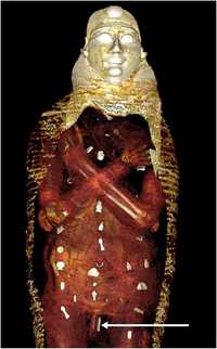 Momia de chico de oro portaba 49 amuletos, revelan tomografías