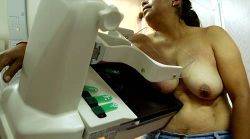 People with cancer live ordeal before reaching a specialist Photo