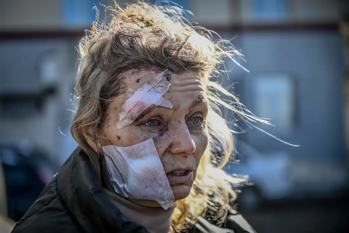 Una mujer herida frente a un hospital después del bombardeo de la ciudad de Chuguiv, al este de Ucrania, cuando las fuerzas armadas rusas intentan invadir a este país desde varias direcciones, para lo que emplea sistemas de cohetes y helicópteros para atacar la posición ucrania al sur. dijo el servicio de guardia, el 24 de febrero de 2022. Foto Afp