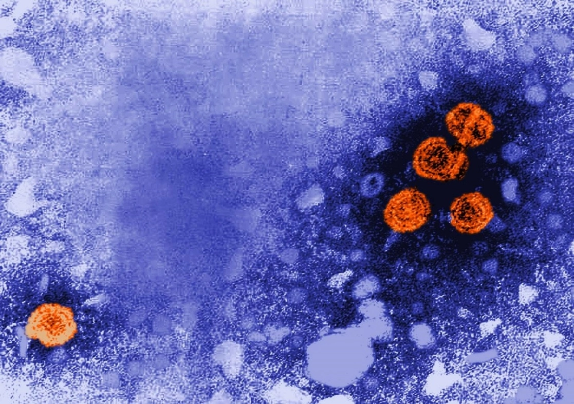 Imagen microscópica que revela la presencia de viriones de la hepatitis B. Foto Europa Press