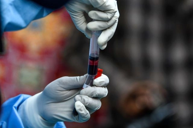 El análisis de sangre no invasivo puede detectar si una persona tiene uno de los cinco tipos comunes de cáncer, cuatro años antes de que la afección pueda ser diagnosticada con los métodos actuales. Foto Afp 