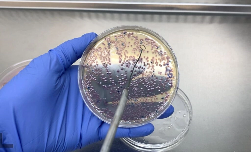 Publicaciones internacionales destacan que seis patógenos causan el 73% de las muertes asociadas a resistencia antimicrobiana: 'E. coli', 'Staphylococcus aureus', 'Klebsiella pneumoniae', 'Streptococcus pneumoniae', 'Acinetobacter baumannii' y 'Pseudomonas aeruginosa'. Imagen tomada de https://unamglobal.unam.mx/global_tv