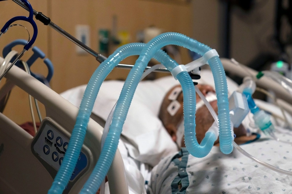 Paciente con Covid-19 permanece intubado en el Centro Médico ‘Providence Holy Cross’ en Los Ángeles, California. Foto Ap
