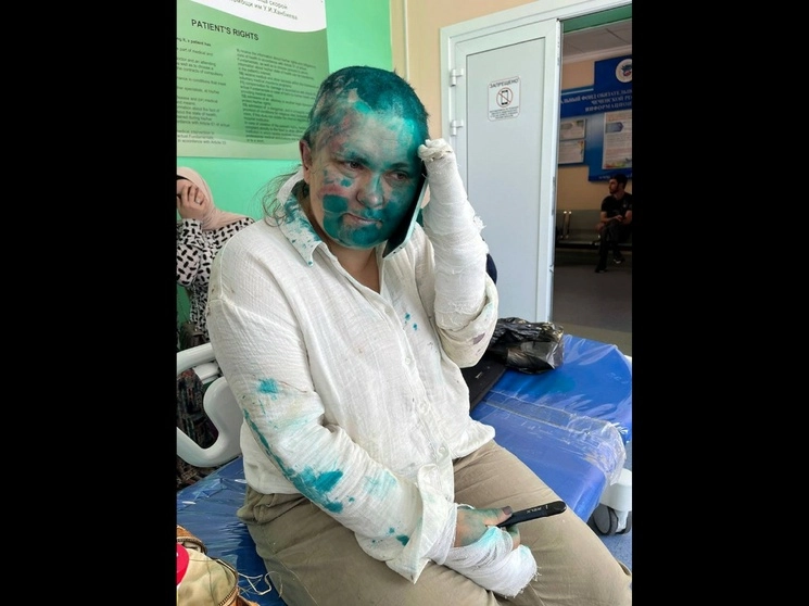 La periodista de investigación Yelena Milashina se desmayó varias veces y tiene conmoción cerebral y rotos varios dedos de las manos, la raparon y le rociaron el rostro con un antiséptico de color verde, el 4 de julio de 2023. Foto Afp 