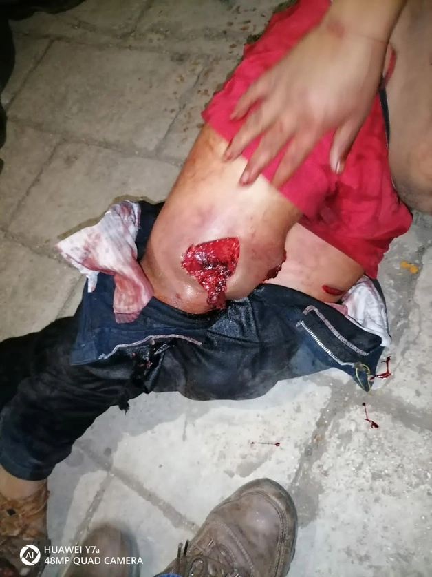 Ambos fueron atendidos y ya se busca al agresor. Foto La Jornada