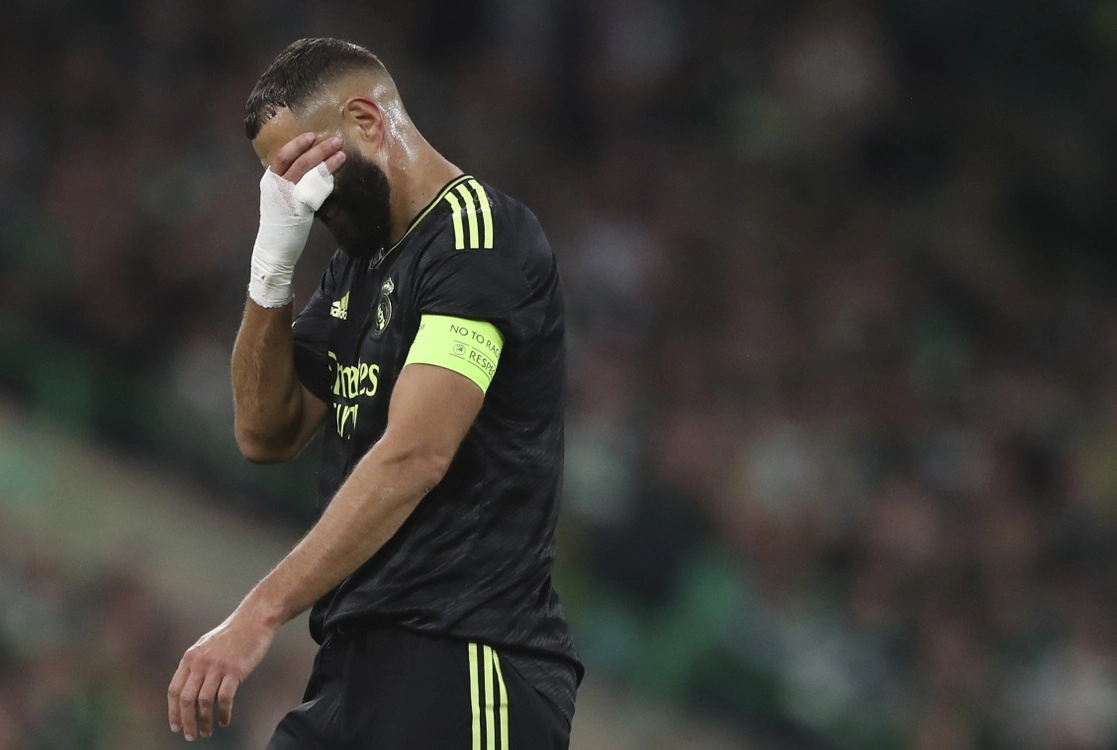 El capitán del Real Madrid, Karim Benzema, sufrió el martes en el partido de ‘Champions’ contra el Celtic una lesión muscular y una sobrecarga en la pierna derecha, informó el equipo merengue. Foto Ap