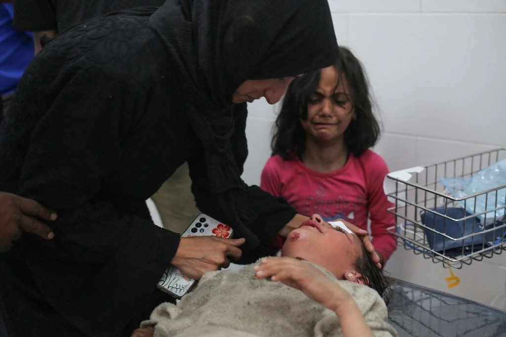 Un niño recibe atención médica en el hospital kuwaití por las heridas sufridas por un bombardeo israelí a un campamento que albergaba a palestinos desplazados cerca del hospital emiratí, en Rafah, en el sur de la Franja de Gaza, el 2 de marzo de 2024. Foto Afp