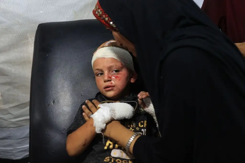 Una niña herida es atendida luego del bombardeo al campo de refugiados de la Unrwa en Nuseirat. Foto Afp
