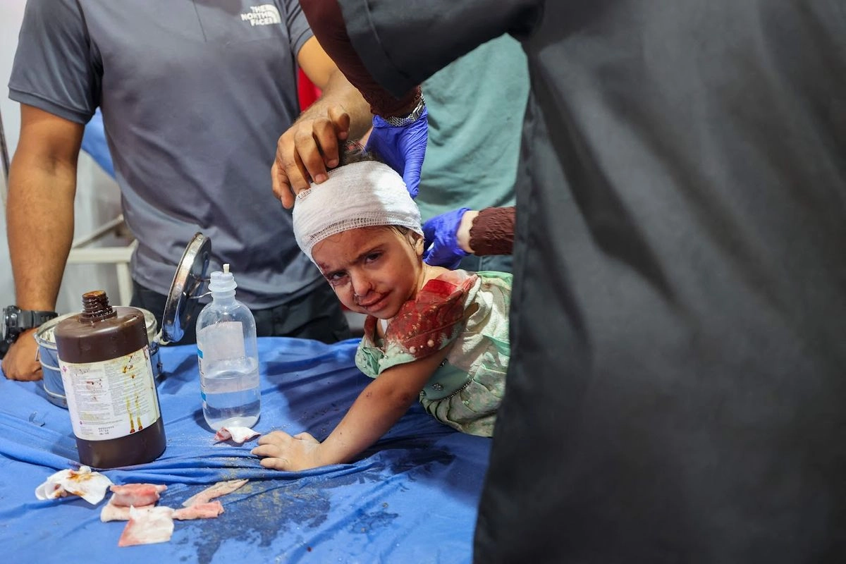 Una niña que resultó herida durante el bombardeo israelí al campo de refugiados de Nuseirat, recibe tratamiento en el hospital Al Awda, en el centro de Gaza. Han resultado lesionados 140 mil 485 habitantes del enclave en el operativo militar ordenado por el régimen de Netanyahu. Foto 