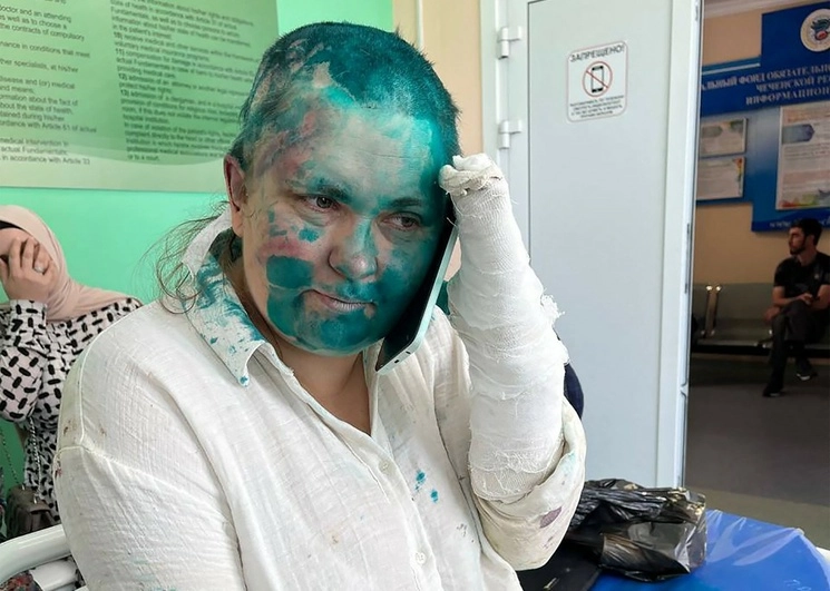 Yelena Milashina, reportera de ‘Novaya Gazeta’, y el abogado Aleksandr Nemov fueron interceptados por hombres armados cuando se trasladaban a la ciudad de Grozni, donde una Corte enjuiciaba injustamente a una mujer. Los enmascarados los golpearon con tubos y a la periodista la rociaron con pintura. “Les advertimos que no vinieran ni escribieran nada”, les gritaron. El presidente ruso, Vladimir Putin, ordenó indagar “a fondo”. Foto Afp