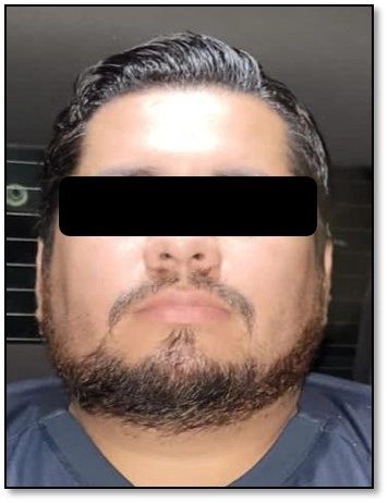 Ricardo “N” tras su detención. Foto Sedena