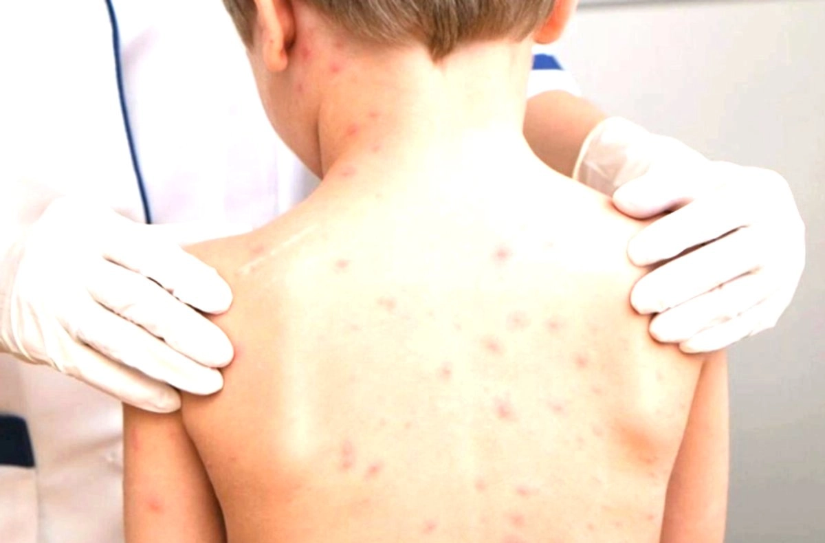 Nadine Gasman Zylberman señaló que se han aplicado 623 mil vacunas en escuelas, centros de salud, hospitales, en kioscos que se instalaron en toda la ciudad, el Metro, terminales de autobuses y el aeropuerto.