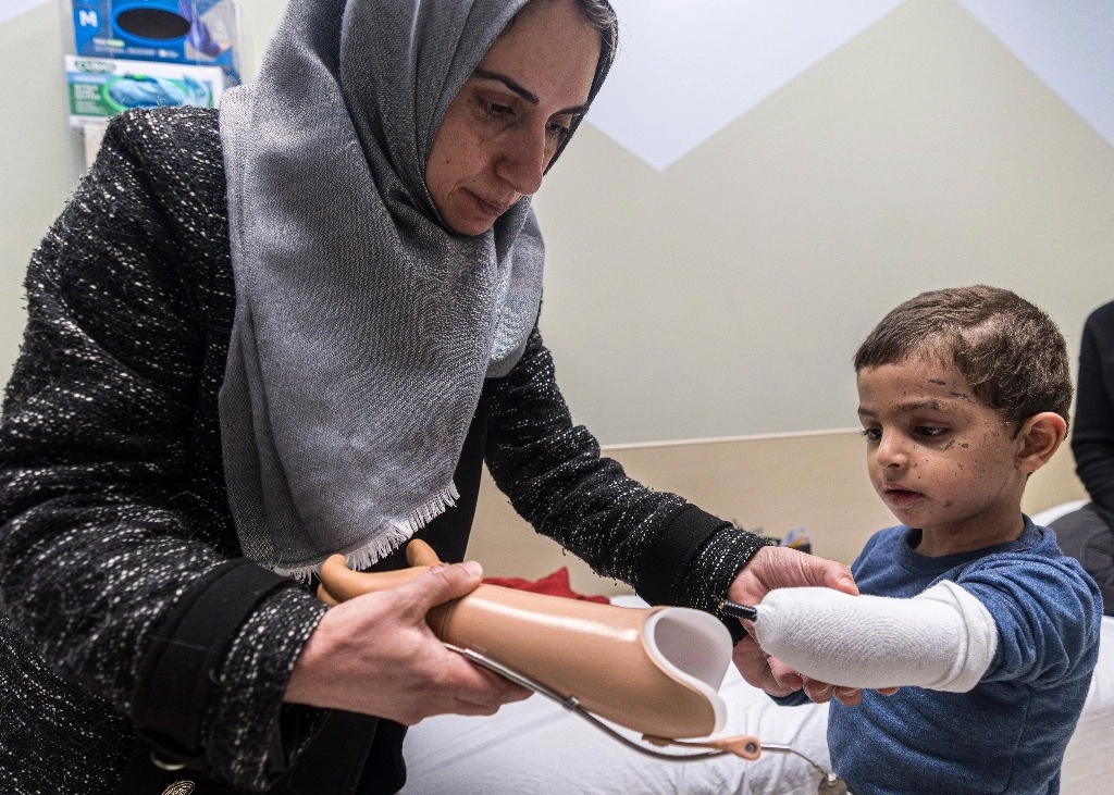 Un niño palestino de 4 años recibió hace unos días una prótesis en un hospital de Filadelfia. Foto Ap 



