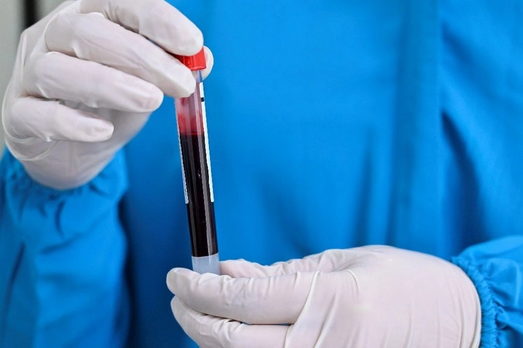 Pruebas de covid en laboratorio. Foto Afp