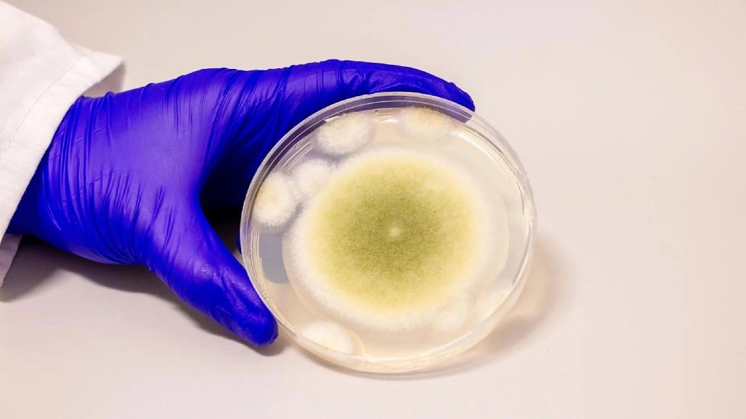  Muestra del ‘Aspergillus flavus’ cultivado en el Laboratorio Gao. Foto 