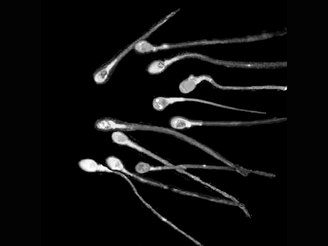 El estudio, publicado en ‘Human Reproduction Update’, compila datos de unas 40 investigaciones anteriores. Según el trabajo, el declive sigue a ritmo acelerado desde principios del siglo XXI. Foto Afp