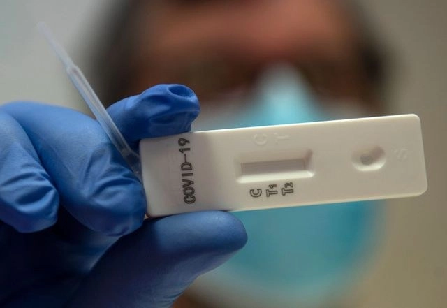 Un análisis genético de muestras de más de 7 mil 500 personas infectadas con Covid-19 sugiere que el nuevo coronavirus se propagó rápidamente por todo el mundo a fines del año pasado y se está adaptando a sus huéspedes humanos, dijeron científicos. La imagen, de una prueba en Roma. Foto Afp