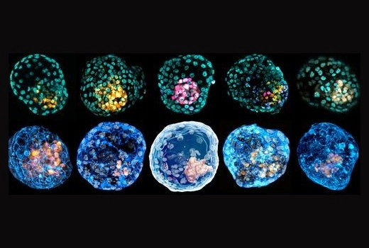Combinación de imágenes microscópicas que muestra diferentes blastoides, estructuras parecidas a embriones humanos. Foto Ap / Archivo