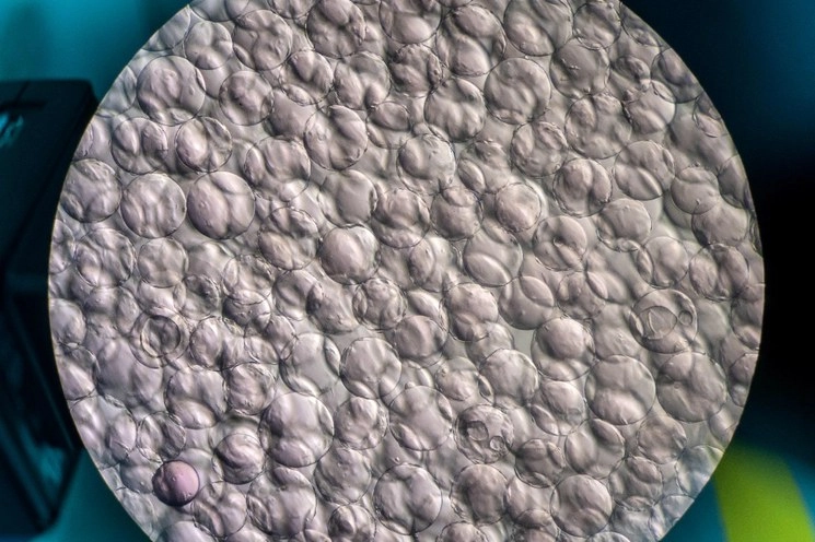 Células de riñón de mono se ven a través de un microscopio como parte de las pruebas de una vacuna experimental para el Covid-19 que desarrollan en el laboratorio Cells Culture Room en las instalaciones de Sinovac Biotech en Pekín. Foto Afp