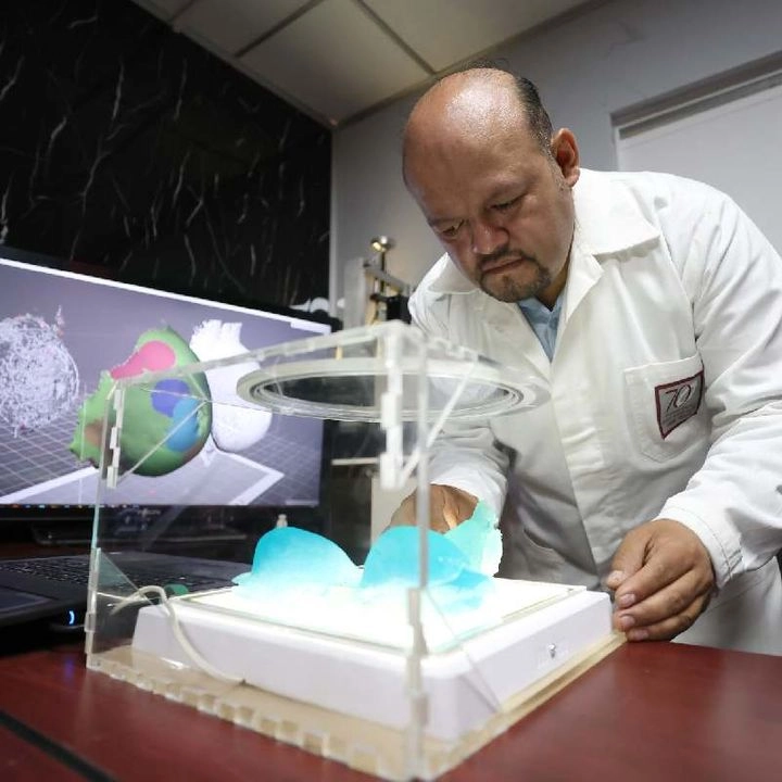 El investigador  Juan Alfonso Beltrán Fernández  explicó que la resina fotopolimérica de uso experimental es pasada por un lente polarizador, lo que genera que el color se intensifique en las zonas donde hay tejido tumoral. Foto
