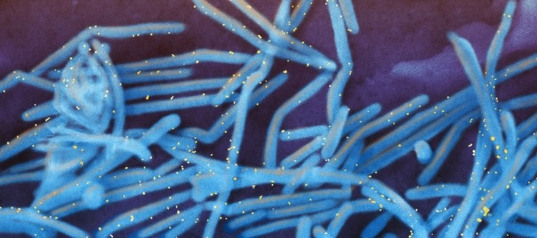 Vista del microorganismo respiratorio sincitial (coloreado en azul) obtenida por microscopía electrónica. Imagen tomada del Twitter de @PLOSPathogens