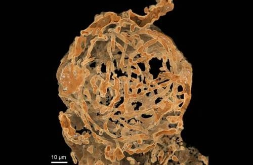 De forma de hilos, fueron encontrados en el aparato reproductor de una hembra. Foto Journal of Royal Society