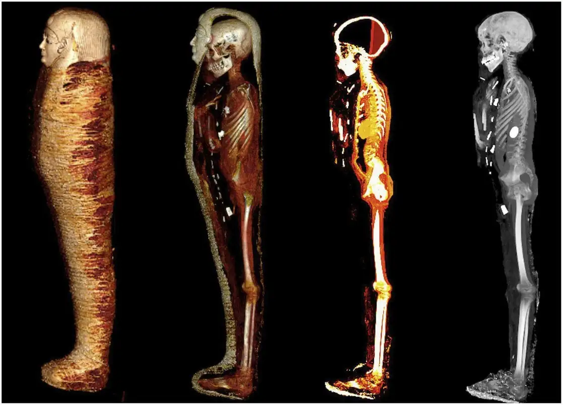 Tomografías computarizadas permitieron ver el cuerpo de un adolescente egipcio de alto nivel socioeconómico, el cual portaba 49 amuletos de 21 tipos para promover su resurrección, muchos de ellos de oro, los cuales fueron colocados cuidadosamente sobre su piel o en el interior. Foto Ap