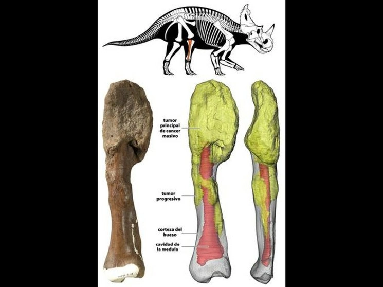 La masa tumoral principal está en la parte superior del hueso y se puede ver en la reconstrucción 3D en amarillo. Foto © Museo Real Ontario/ Universidad McMaster