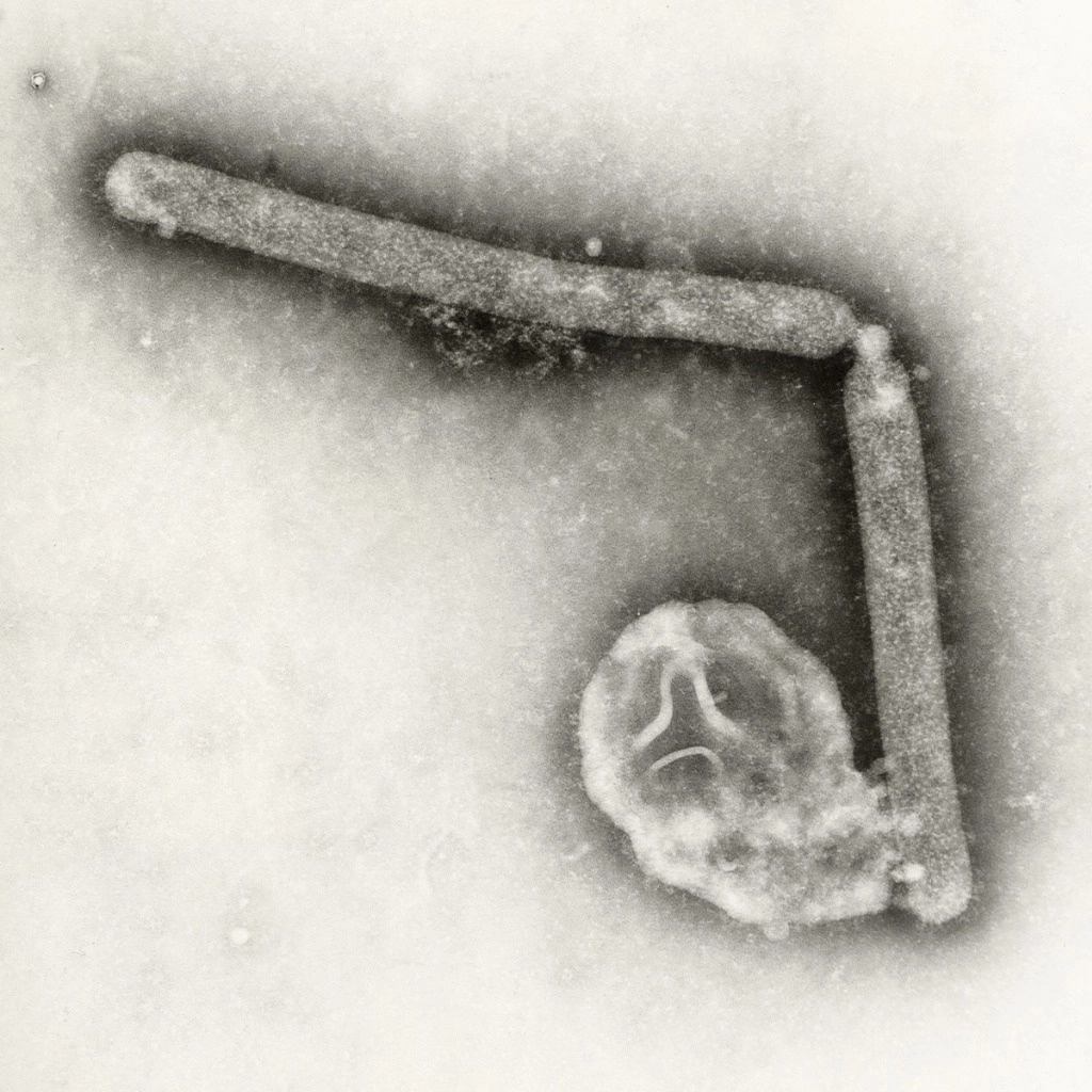 Imagen en microscopio de dos viriones de la influenza A (H5N1), un tipo de virus de la gripe aviar. Foto CDC vía Ap