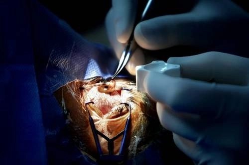 El descubrimiento ofrece la posibilidad de identificar nuevos blancos moleculares para tratar la enfermedad, según publican sus autores. Foto Marco Peláez / Archivo