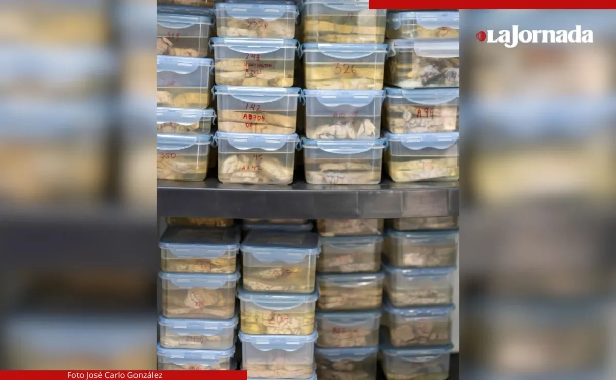 El biobanco alberga una colección de 20 cerebros humanos y 400 fragmentos de tejidos. Foto 