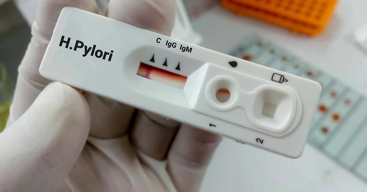 Prueba de detección de la bacteria 'Helicobacter pylori'. 