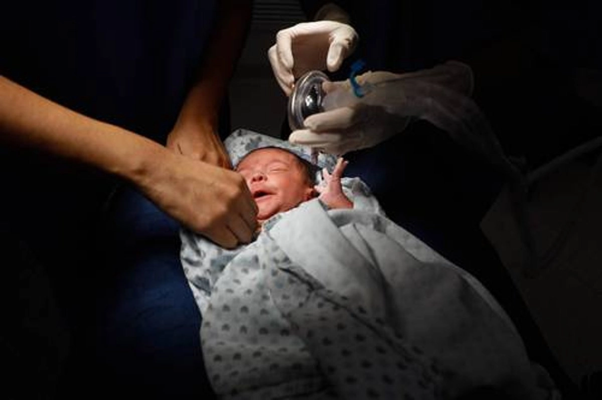 Un bebé de apenas un mes fue intervenido ayer para evitarle ceguera irreversible por un padecimiento conocido como retinopatía del prematuro. Foto 