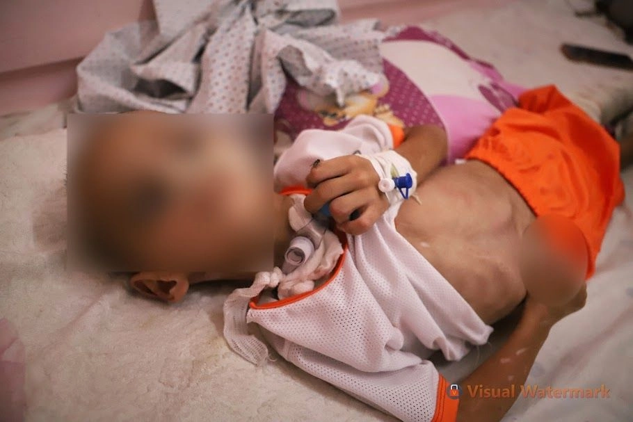 Este menor está internado en el hospital de Nasser, en Gaza, desde abril, cuando su familia fue víctima de los ataques de Israel. A partir del inicio de la ofensiva de Tel Aviv han sido asesinados 57 mil 338 palestinos. Foto 