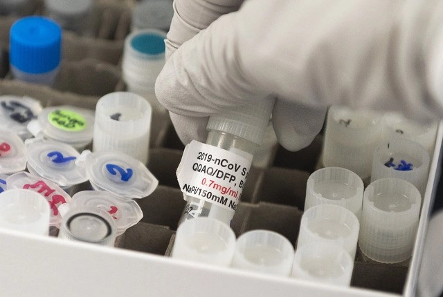 Potencial vacuna contra el coronavirus, en los laboratorios de Novavax en Rockville, Maryland. Foto Afp 